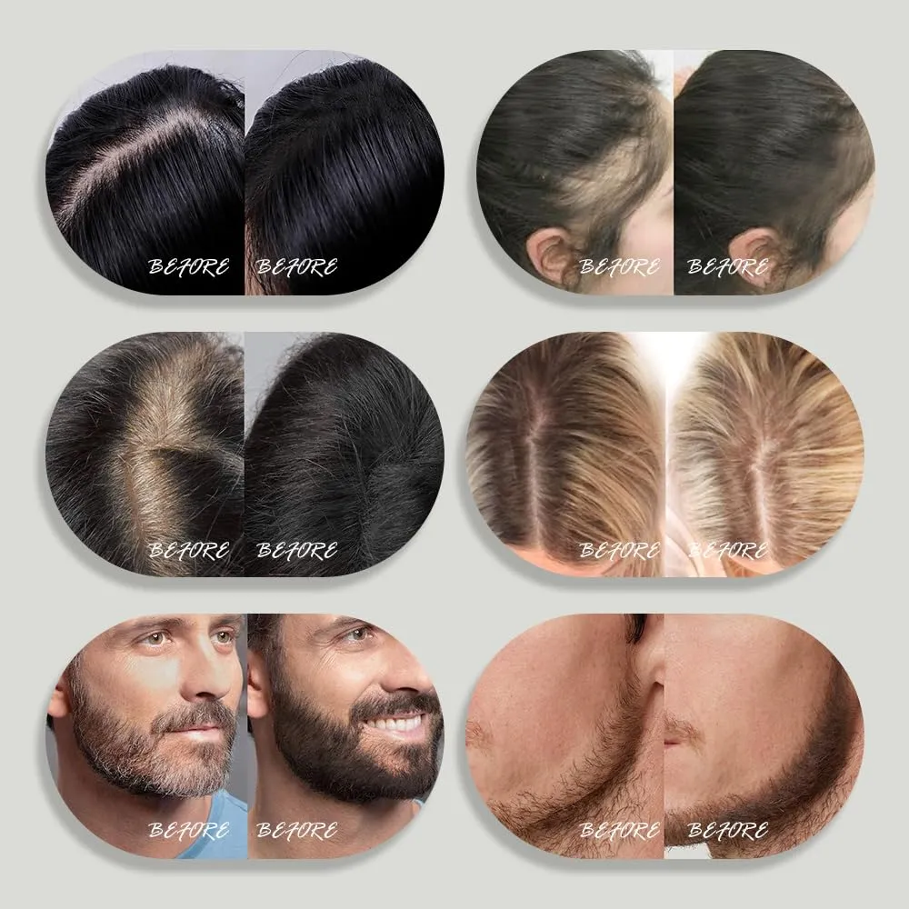10g Minute Hair Hairline shadow powder waterproof root retouch cover Up powder Thicker Fuller cover grey hair and Beard instantly for men and women (LIGHT BLONDE)